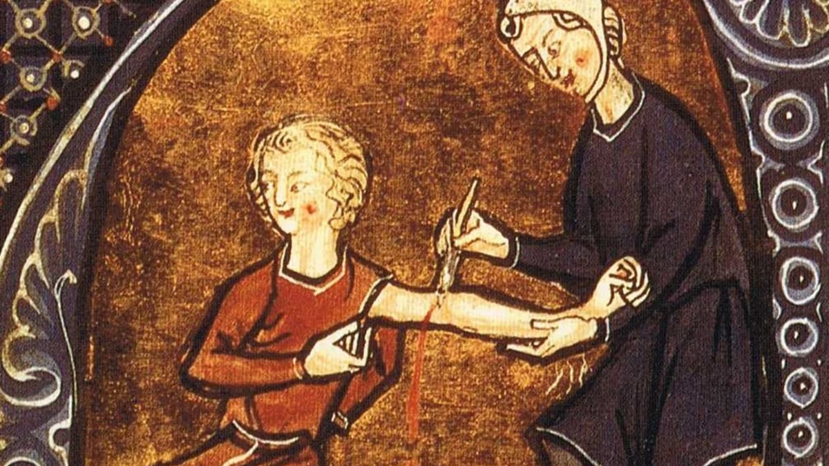 Středověké pouštění žilou