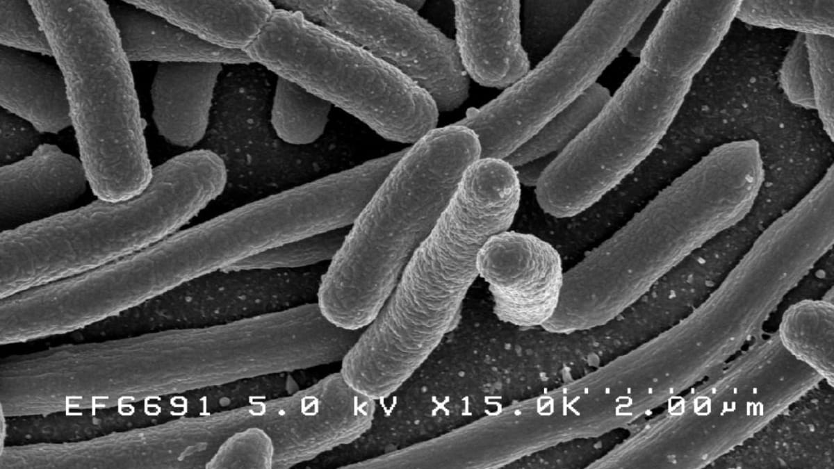 Střevní bakterie Escherichia coli