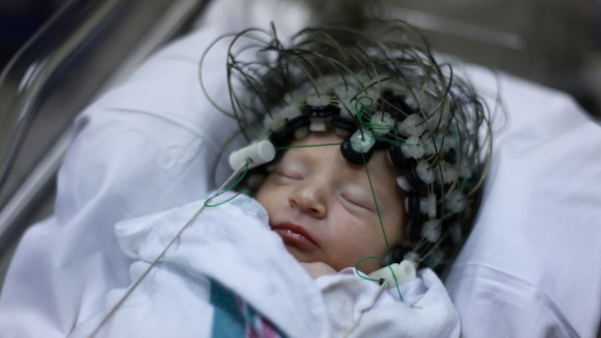 Dítě s elektrodami na hlavě