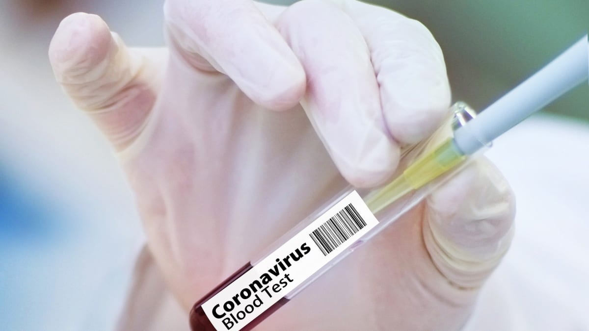 Hledání vakcíny proti koronaviru jede na plné obrátky