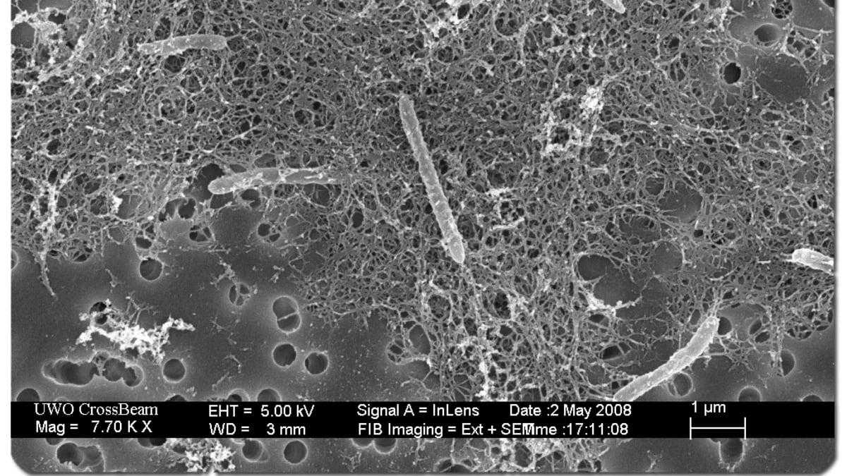 Desulforudis audaxviator je grampozitivní bakterie z kmene Firmicutes žijící v extrémních podmínkách.