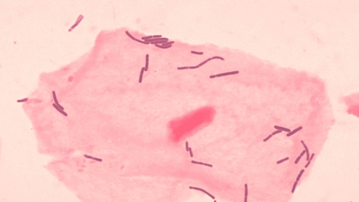 Lactobacillus ve vaginální tkáni