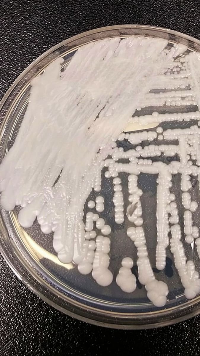Kolonie Candida auris rostoucí v Petriho misce