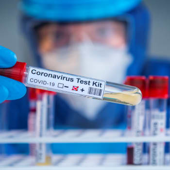 Přihlásili byste se jako dobrovolník k testům vakcínu na COVID-19?