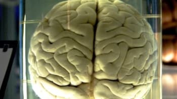 3000 lidských mozků - hodně COOL sbírka