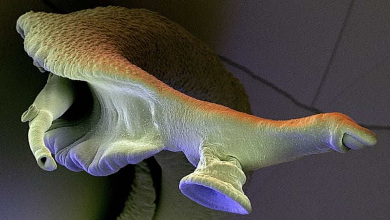 Krevnička střevní je parazitický helmint z čeledi Schistosomatidae, který způsobuje tzv. střevní schistosomózu. Při onemocnění jsou většinou zasažena játra a tlusté střevo.
