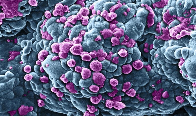 Rakovinové bujení (modře) je napadeno doxorubicinem, který způsobuje jejich zánik. Umírající rakovinové buňky jsou fialové