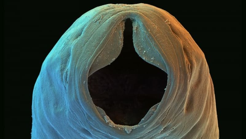 Měchovec americký – červ ze skupiny měchovců Nematoda, původce ankylostomózy