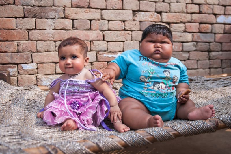 Nevysvětlitelně tloustnoucí dítě z Indie - Obrázek 6