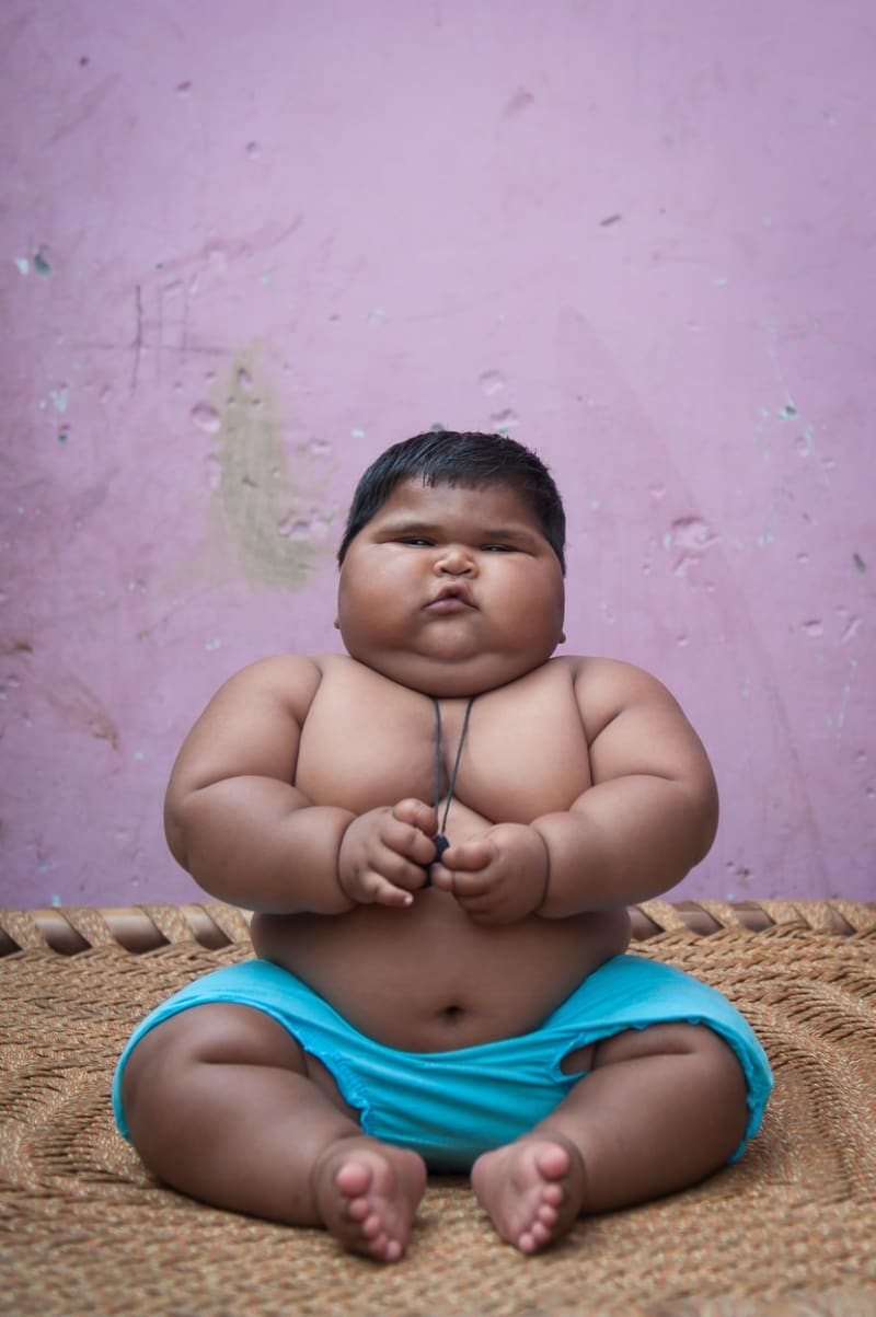 Nevysvětlitelně tloustnoucí dítě z Indie - Obrázek 2
