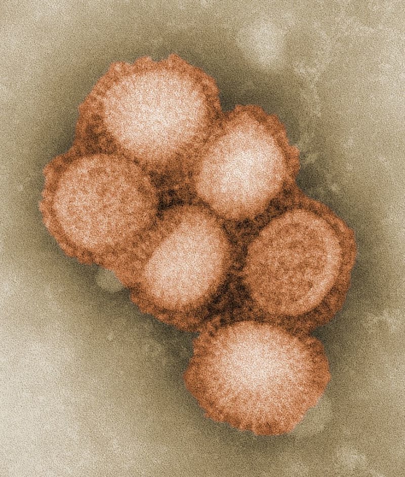 Virus prasečí chřipky