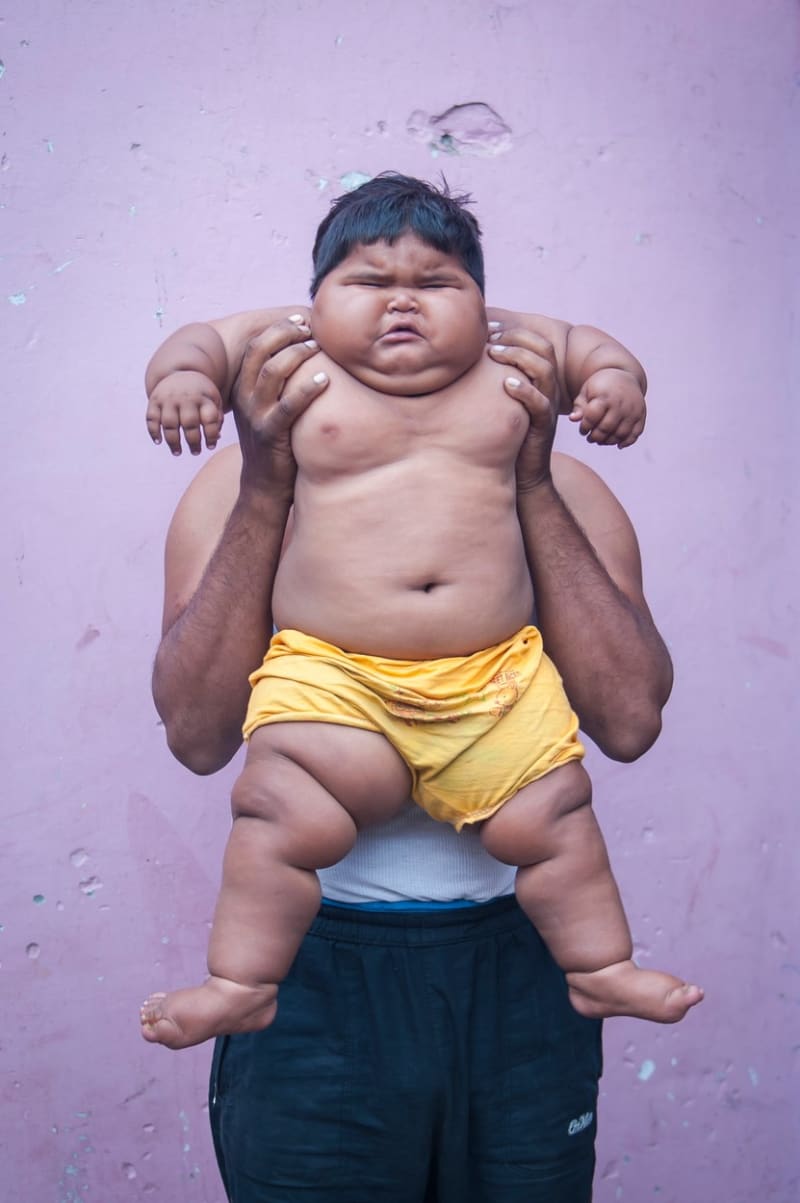 Nevysvětlitelně tloustnoucí dítě z Indie - Obrázek 1