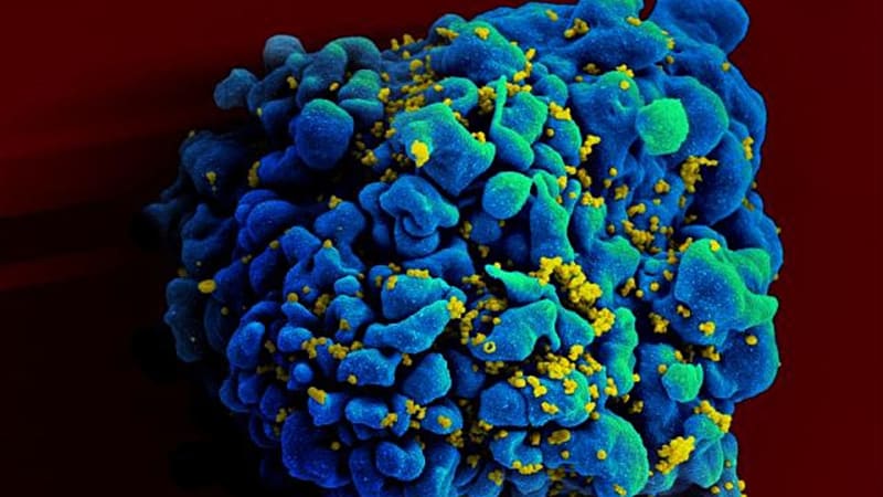 Kdyby virus HIV zmutoval, zničil by lidstvo?