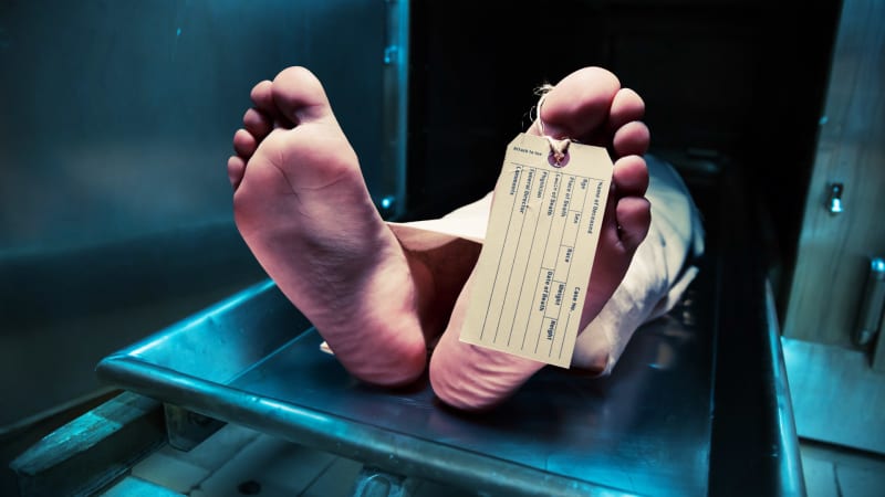 Mrtvý dárce skončil jako morbidní atrakce při veřejné pitvě. Co všechno se s tělem dělo?
