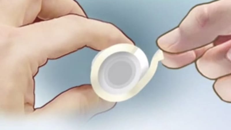 Antikoncepce budoucnosti: miniprezervativ, implantáty, co se samy rozpustí, i genetické triky