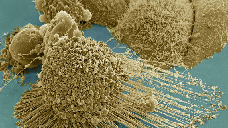 Rakovinu zničí umělý nádor – vytištěný z 3D tiskárny