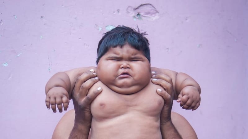 Epidemie obezity v Indii: proč tamní kojenci extrémně tloustnou?