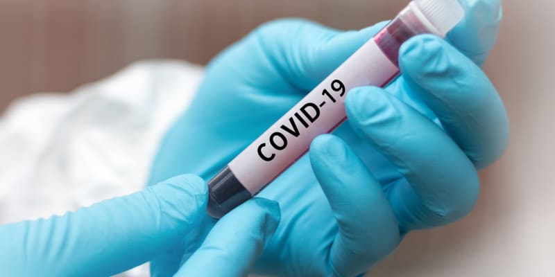 Koronavirus ochromil celý svět v podstatě na dva roky.