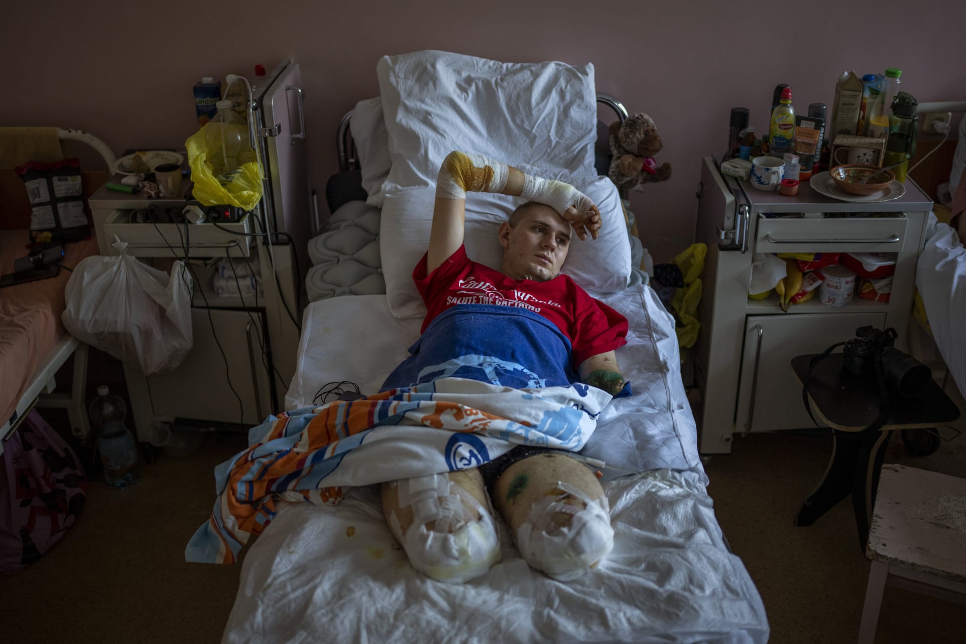 Vojenský lékař Anton Gladun (22) přišel na východě Ukrajiny na konci března o obě nohy a levou ruku při explozi miny. Fotografie byla pořízena 5. května v nemocnici ve městě Čerkasy