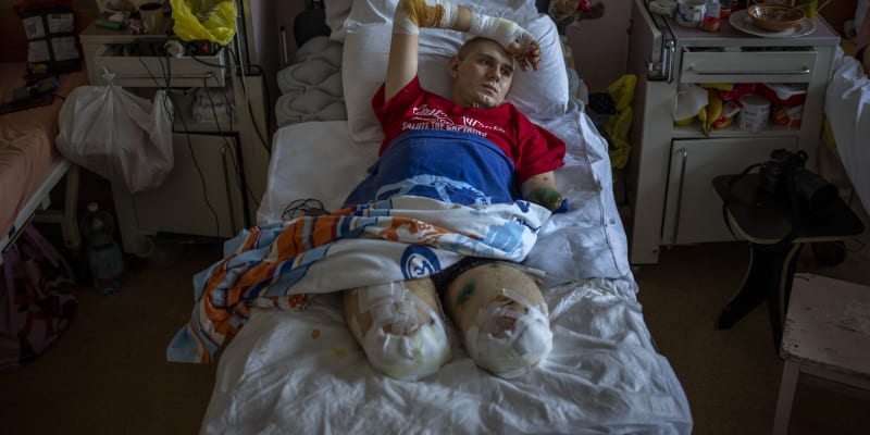 Vojenský lékař Anton Gladun (22) přišel na východě Ukrajiny na konci března o obě nohy a levou ruku při explozi miny. Fotografie byla pořízena 5. května v nemocnici ve městě Čerkasy