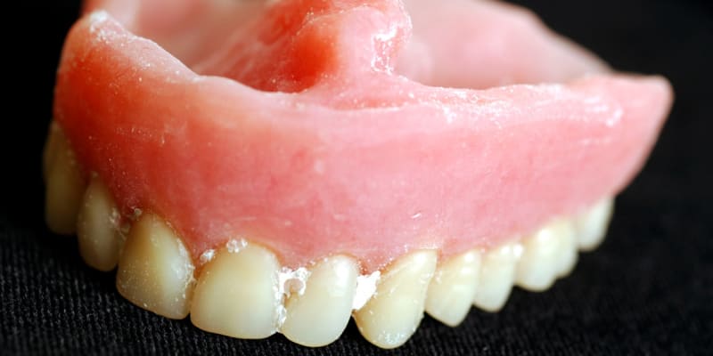 Pokud si zbrousíte zdravé zuby, vystavujete se riziku dalších problémů.