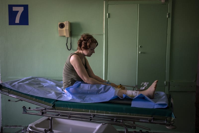 Olena Viterová (45) přišla při výbuchu nejen o levou nohu, ale také 14letého syna Ivana. Fotografie z 10. května zachycuje její přemisťování na operační sál v kyjevské nemocnici.