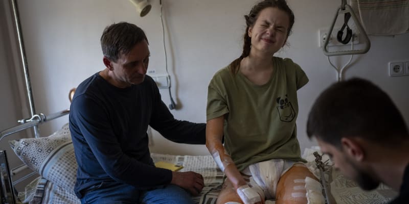 Nasťu Kuzikovou (21) zastihl 17. března v Černigově bombový útok, když se vracela do krytu. Přišla o pravou nohu pod kolenem.