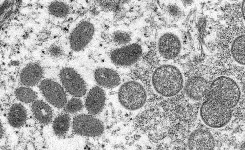 Viry opičích neštovic pod mikroskopem. Nemocí se může nakazit i člověk.