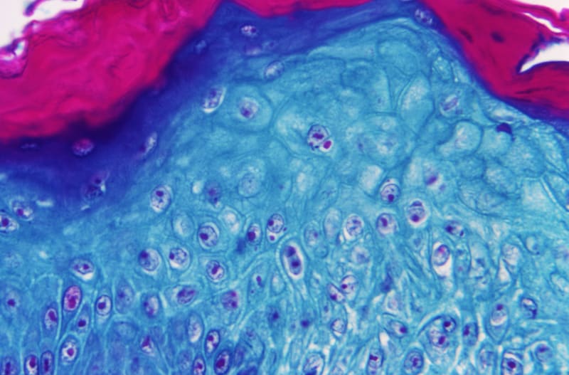 Mikroskopická ukázka znázorňuje kožní tkáň opice nakaženou opičími neštovicemi.