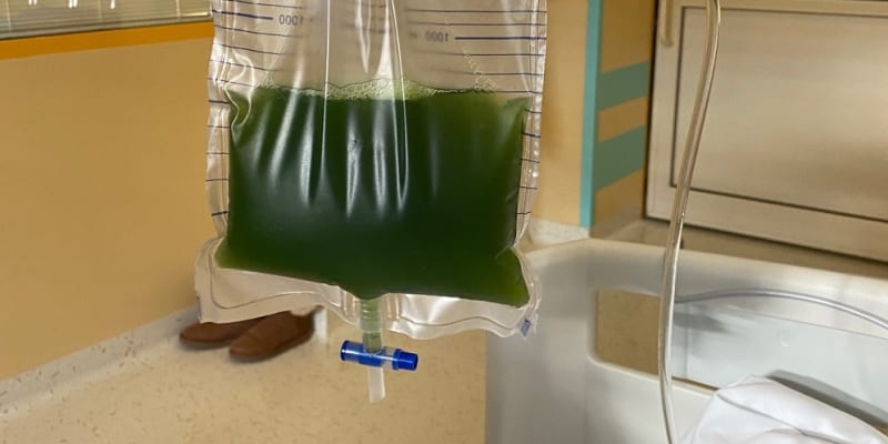 Obsah žaludku připomínal zelený sliz. 