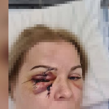 Žena, které zabodl teprve čtrnáctiletý agresor nůž do oka a zaútočil jí i na krk, poté co se pokusil zavraždit jejího syna, přinesla mrazivé svědectví.