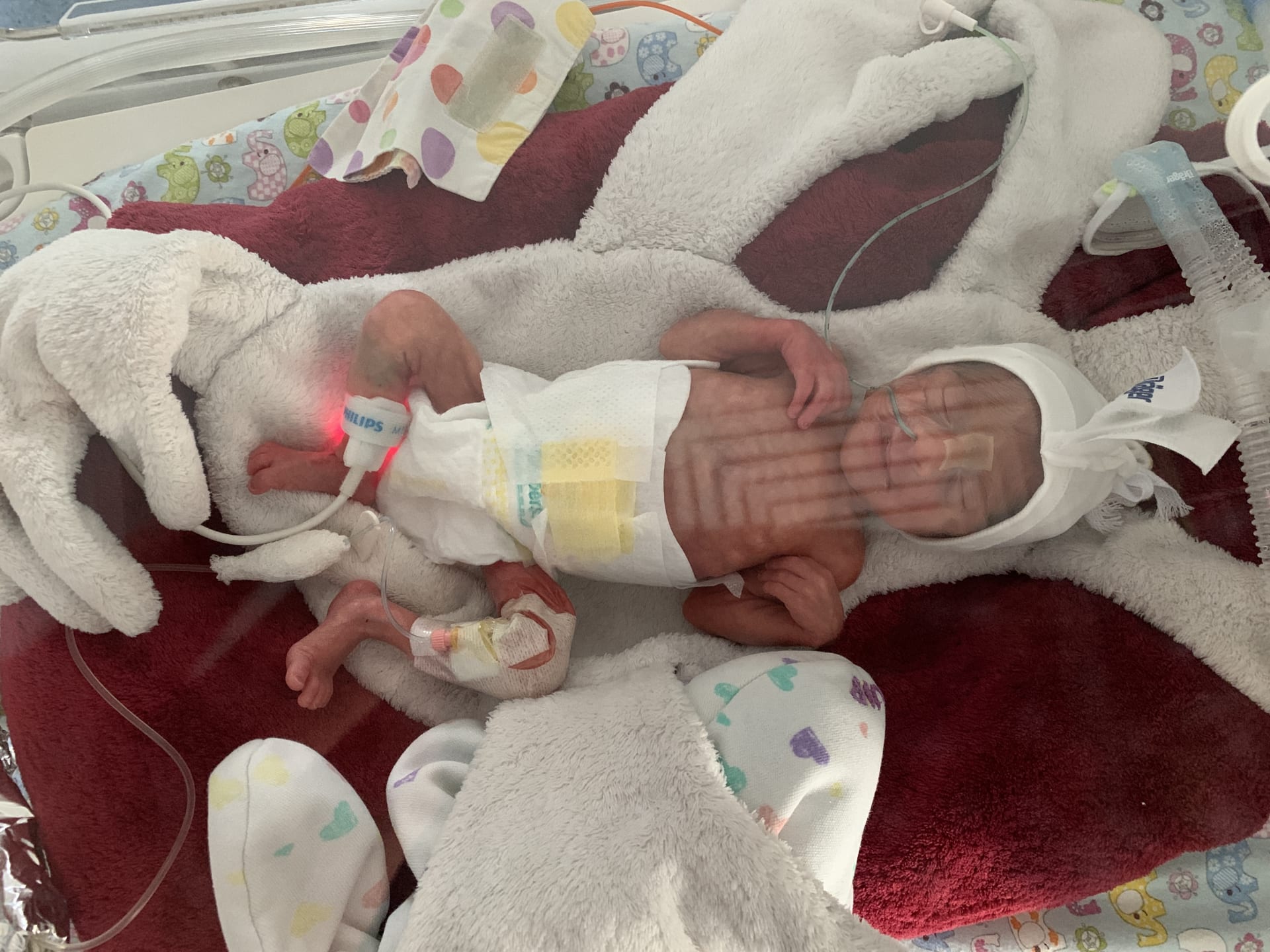 Viktorka vážila pouhých 820 gramů. Narodila se téměř o tři měsíce dříve. 