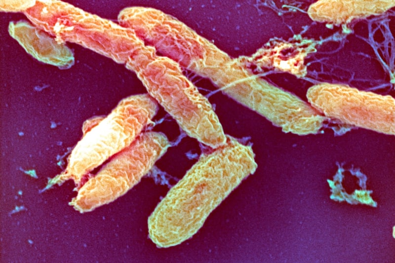 Morová bakterie Yersinia pestis