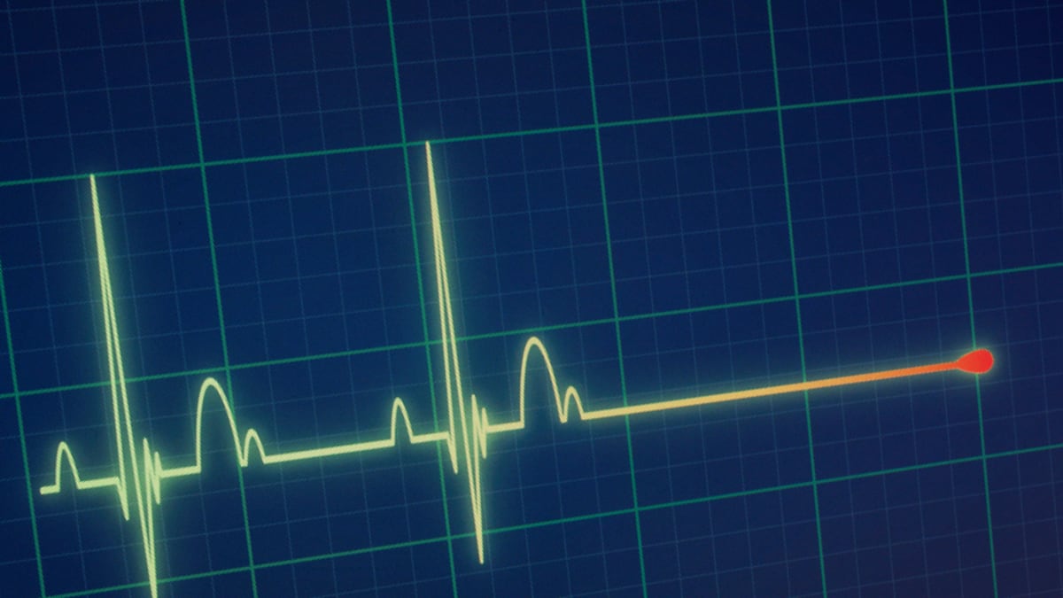EKG monitor sledující srdeční činnost