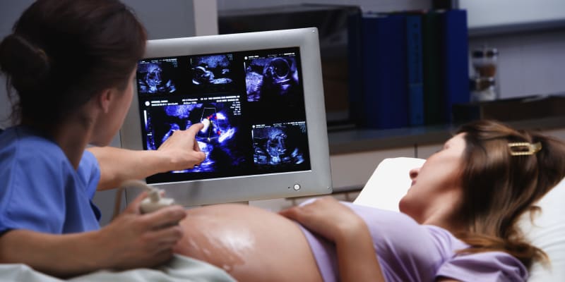 Těhotná žena na ultrazvuku