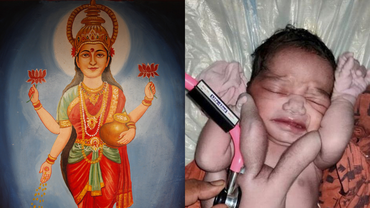 Indické dítě (vpravo) se před pár dny narodilo se čtyřma rukama a čtyřma nohama, tamní obyvatelé jej okamžitě začali spojovat s hinduistickou bohyní Lakšmí.