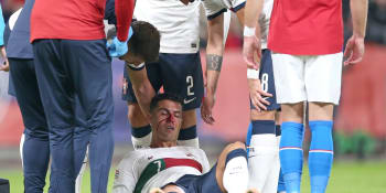 Ronaldo a Schick skončili v krvi. Fotbalisté prohráli s Portugalskem 0:4 a jsou poslední