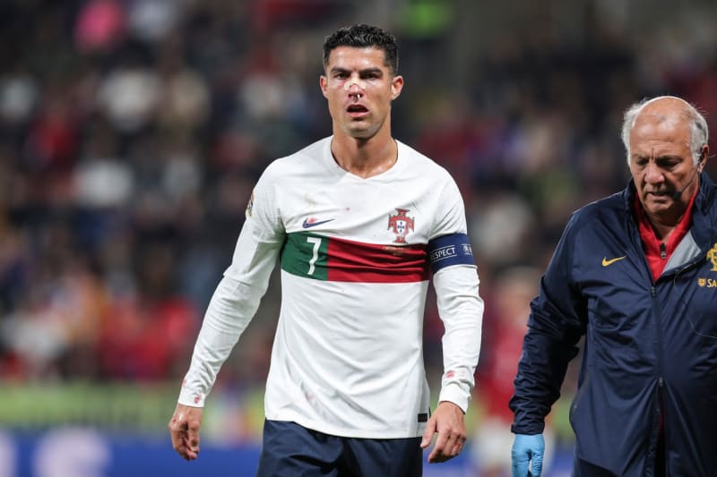 Drsný zápas Česka s Portugalskem. Krev prolili Cristiano Ronaldo i Patrik Schick