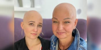 Nemoc, která ničí sebevědomí. Alopecie je v rodině Marcely dědičná, s dcerou sní o vlasech