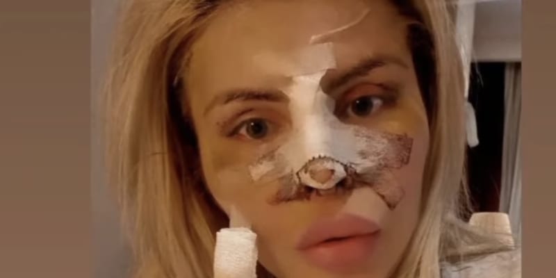Lela Ceterová má krátce po operaci, kterou podstoupila v dalekém Íránu