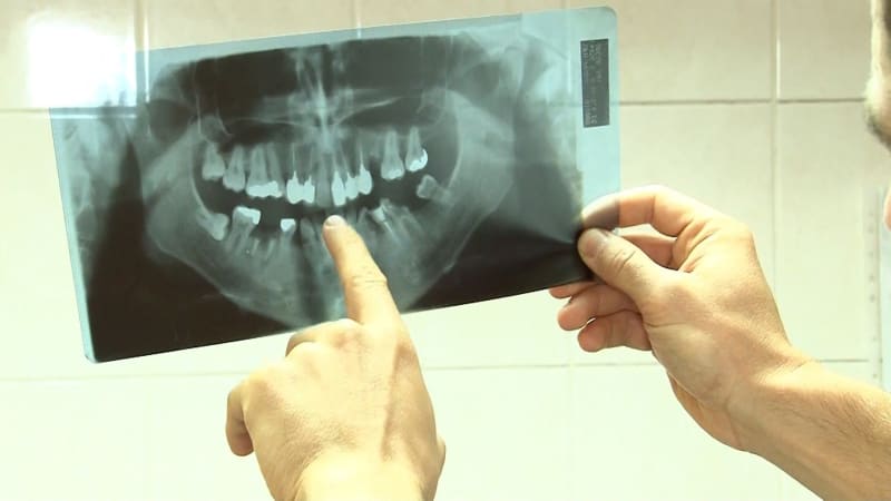 V Žacléři na Trutnovsku vždy býval zubní lékař, teď je ale stomatologická ordinace prázdná.