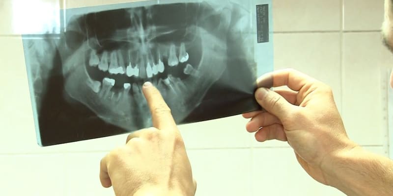 V Žacléři na Trutnovsku vždy býval zubní lékař, teď je ale stomatologická ordinace prázdná.