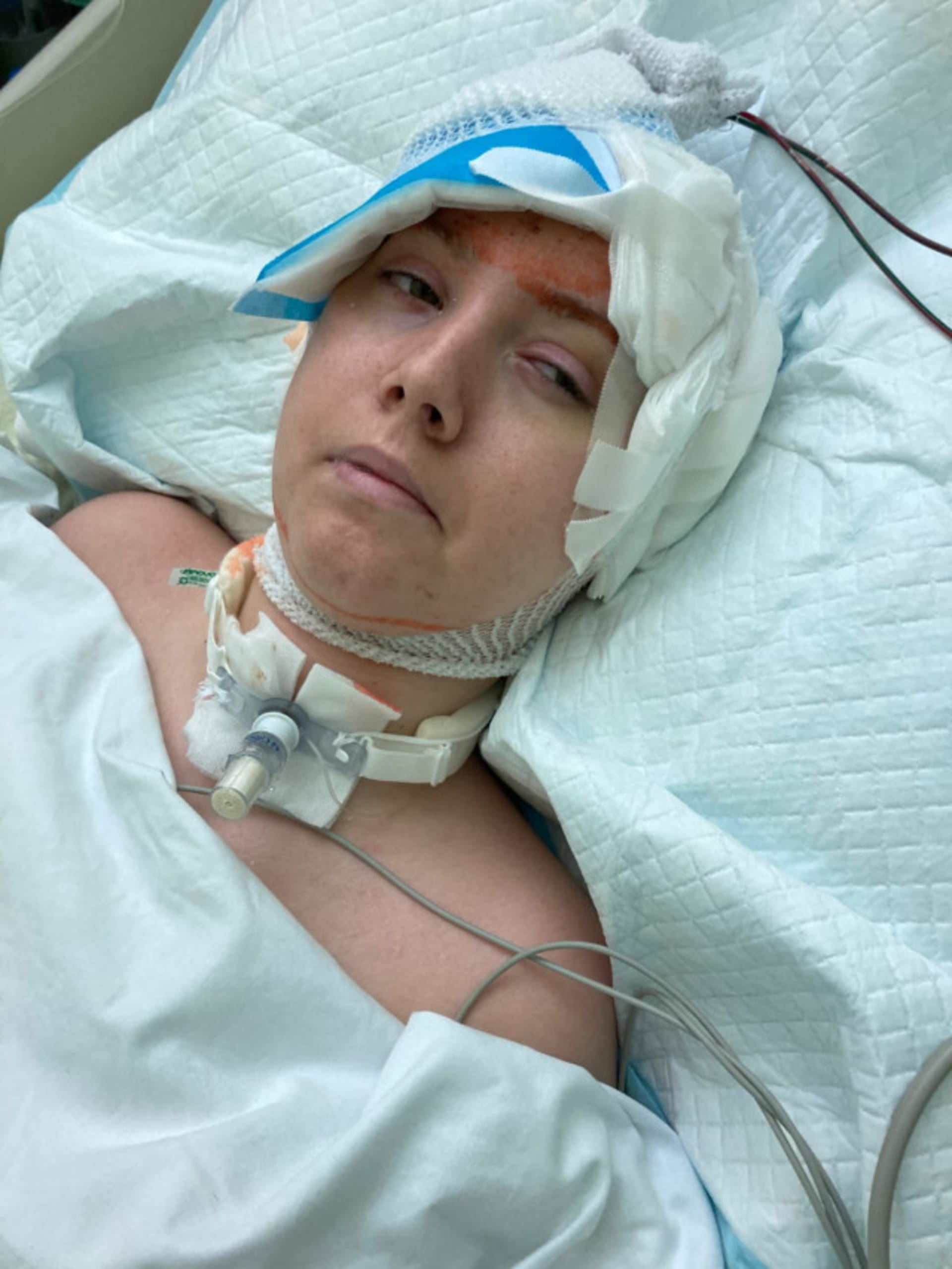 Zdeňka Jakabová utrpěla před třemi lety při dopravní nehodě vážné zranění hlavy. Dnes je připoutaná na lůžku.