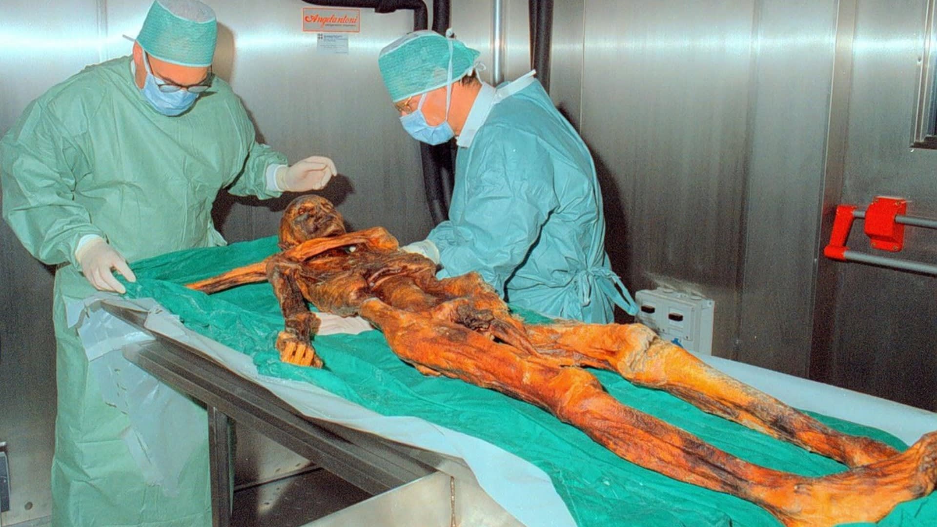 Ötzi tělo