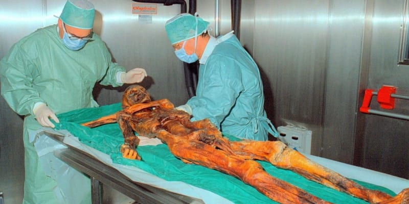 Ötzi tělo