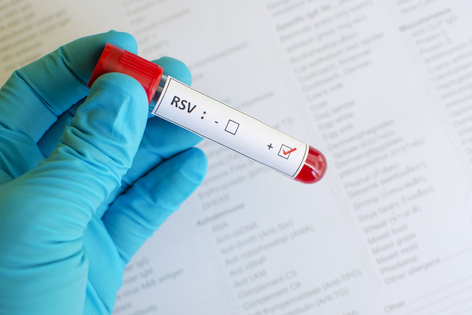 RSV se diagnostikuje sérologickým rozborem