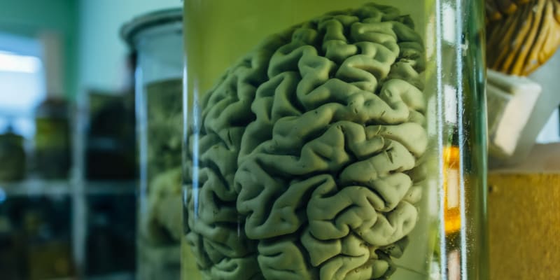 Lidský mozek po smrti mění konzistenci