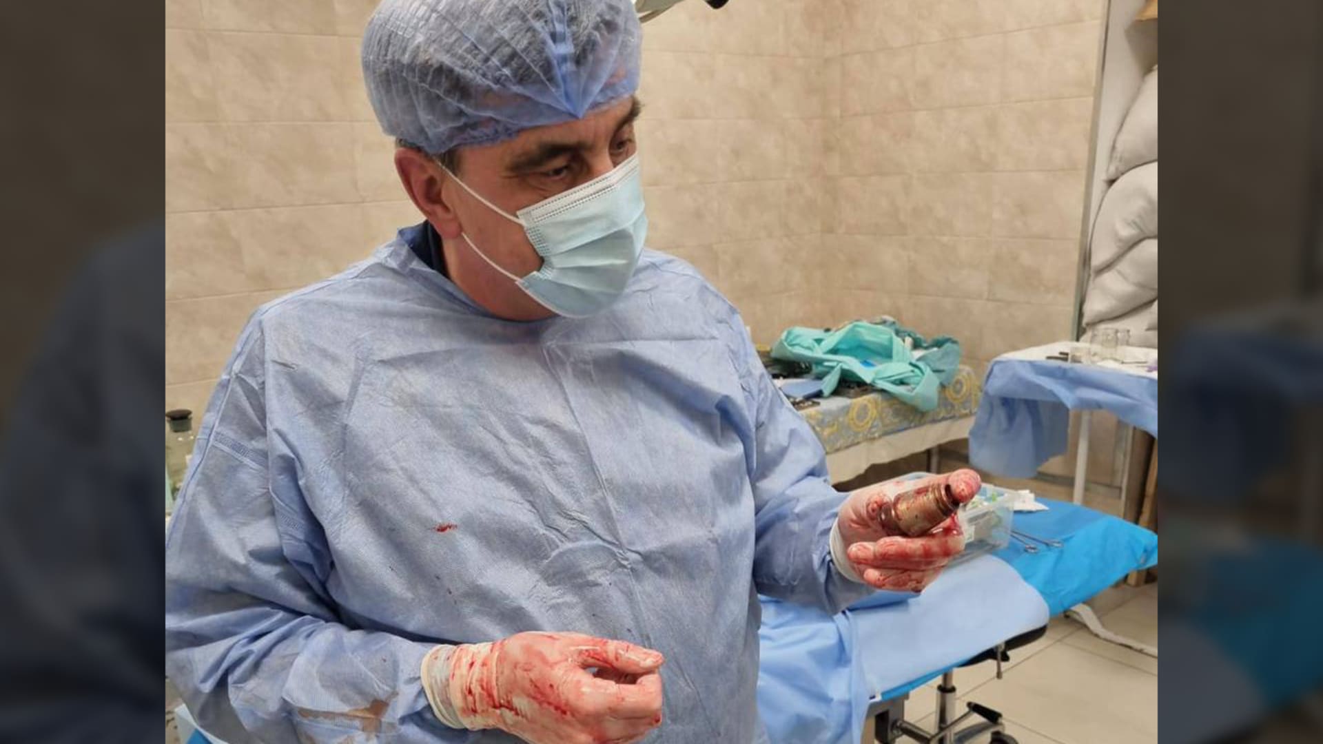 Ukrajinský lékař Andrij Verba vyoperoval muži z těla granát.