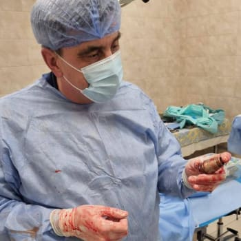 Ukrajinský lékař Andrij Verba vyoperoval muži z těla granát.