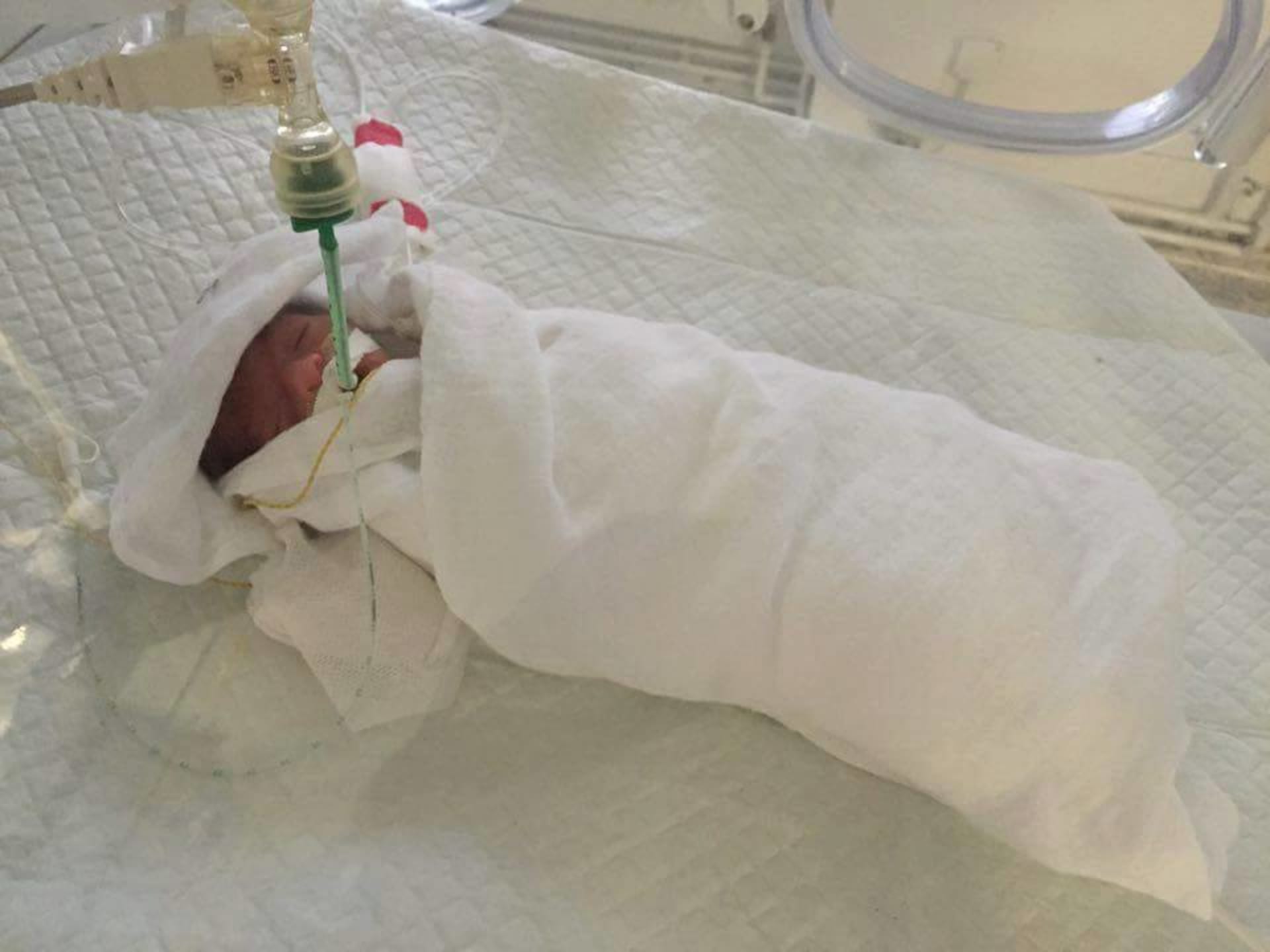Natálka se narodila ve 26 týdnu těhotenství s váhou pouhých 680 gramů.
